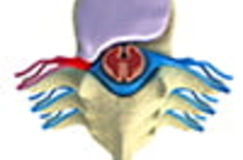 Грыжа поясничного отдела позвоночника – наиболее часто встречающаяся патология спины. Основные симптомы: боль в пояснице, усиливающаяся при физических нагрузках и отдающая в ягодицы и ногу, ограниченность движений, спазмированность мышц. В большинстве слу