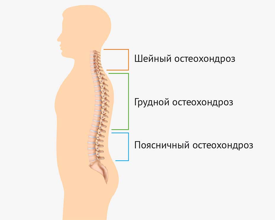 Лечение остеохондроз суставов фитотерапия симптомы ревматизма суставов