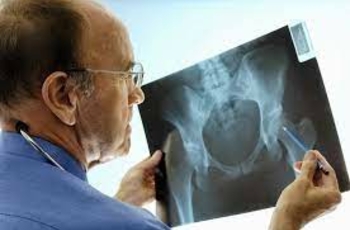 Мраморная болезнь – патология, противоположная остеопорозу. Характеризуется излишней плотностью кости и склерозным поражением костного мозга. Достаточно редко встречается, но так как малоизученна – тяжело поддается лечению. Опасна патологическими перелома