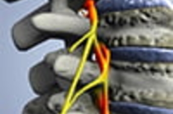 Унковертебральный артроз шейного отдела позвоночного столба означает появление на межпозвоночных дисках костных наростов. Тоже самое происходит и с позвоночными суставами. Первым признаком данного заболевания является боли и хруст во время поворотов голов