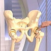 Врачам так и не удалось окончательно выяснить причину столь странного заболевания. Хота нужно отметить, что за последнее время они продвинулись в изучении самого действия болезни и возможных отклонений организма, которые способствуют ее развитию.