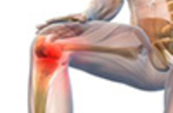 Ревматоидный артрит – это воспалительный патологический процесс, поражающий соединительнотканные структуры, формирующие суставы. Однако если своевременно начать его лечение при помощи народных средств, то можно быстро избавиться от симптомов.