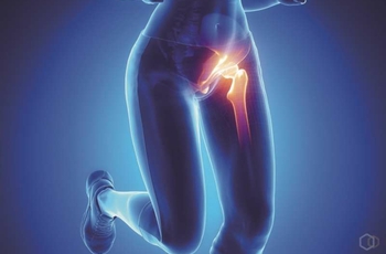 Травматизация тазобедренного сустава происходит из-за излишней нагрузки на нижние конечности. Проблема сопряжена с болезненными ощущениями и появлением гематомы в месте повреждения. Существует различные методы устранения растяжения.
