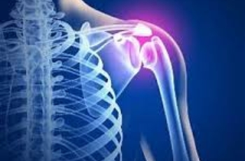 Причины возникновения остеохондроза шейно-плечевого сустава. Симптомы заболевания, по которым его можно определить, течение болезни. Традиционные и народные методы лечения пациентов. Профилактика обострений заболевания.