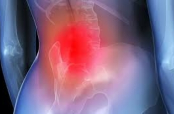 Спондилоартроз (фасеточная артропатия) – это дегенеративное заболевание суставов позвоночника, которое чаще всего поражает шейный или поясничный отдел и иногда развивается параллельно со спондилезом.