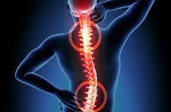 Такое заболевание, как остеохондроз является основной причиной болей в спине и различных проблем с двигательными функциями организма. Для остеохондроза характерны дегенеративные изменения межпозвонковых дисков, приводящие к реактивным процессам в других т