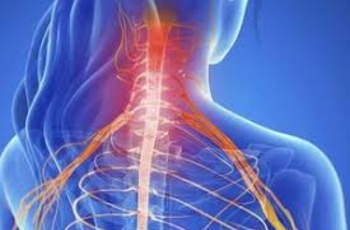 Радикулит (радиокулопатия) также называемый корешковым синдромом - комплекс характерных признаков, которые возникают при сдавливании нервов спинного мозга, часто сопровождающихся различными воспалительными процессами.