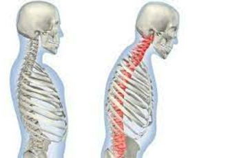 Причины болей в спине могут быть разными, например, сильная нагрузка на позвоночник, сидячий образ жизни, возраст. Самыми распространенными болезнями позвоночника являются радикулит, остеохондроз, артрит и т.д.