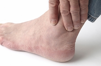 Остеоартроз стопы – это самое распространенное дегенеративное заболевание суставов ног, которое связано с разрушением суставных хрящей. В данной статье мы расскажем о причинах, симптомах и способах лечения остеоартроза стопы.