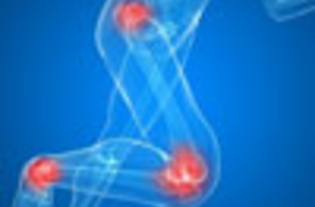 В статье освещается тема гипермобильности суставов: что это такое, симптомы и причины их свободного движения. Опасно ли, когда у человека повышена подвижность суставов, лечение для их укрепления и предотвращения излишнего сгибания.