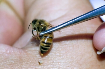 Апитерапия – это метод лечения различных патологий с помощью воздействия на больного пчёл, которые жалят его в поражённые места. Благодаря этому методу можно справиться с заболеванием без хирургического вмешательства. 