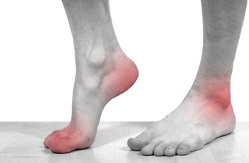 Иногда пациенты сталкиваются с болью в лодыжках и ступнях, списывая симптомы на плоскостопие. Однако причиной дискомфортных ощущений может быть патология большеберцового нерва. Поэтому заболевание необходимо дифференцировать.