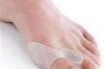 Появление «шишек» на пальцах ног меняет внешний вид стопы и создает дискомфорт при ходьбе. Это влияет на суставы и позвоночник, поэтому не следует игнорировать «косточки», ведь они могут быть первым симптомом более тяжких заболеваний.